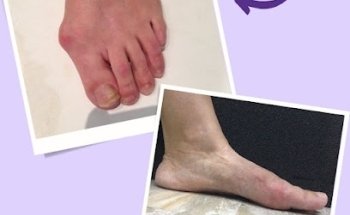 Clínica PodiaFys - Podólogo Málaga