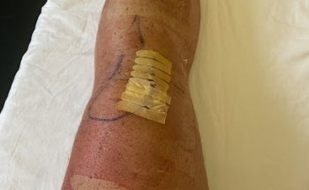 Dott.ssa OMT Monica Ensoli, FISIOTERAPIA-TERAPIA MANUALE-GINNASTICA POSTURALE