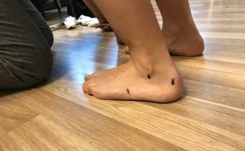 Michele Loss Frizzera - Fisioterapista - Studio Fisiotrento